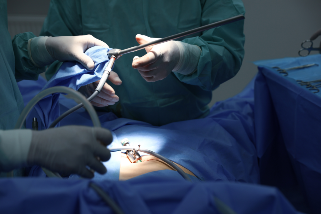 Laparoscopy vs. Open Surgery: Why Women in Gujarat Prefer Dr. Mohil Patel’s Approach